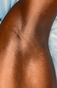 Waxing